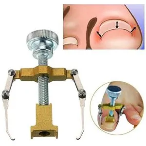 Ingrown Toenail Tool  Lifter Clamp Toe Nail Correction For Paronychia