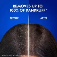 Head & Shoulders Citrus Fresh Anti-Dandruff Shampoo for Greasy Hair 200ml