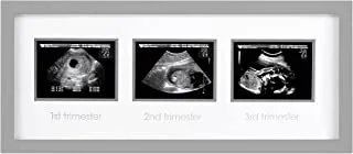 Pearhead Triple Sonogram Picture Frame, Pregnancy Keepsake Photo Frame, Gender-Neutral Baby Nursery Décor